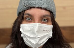 صورة قريبة تُظهر تحول لون العين إلى درجة فاتحة من الأخضر المائل للأزرق بعد إجراء صبغة القرنية.