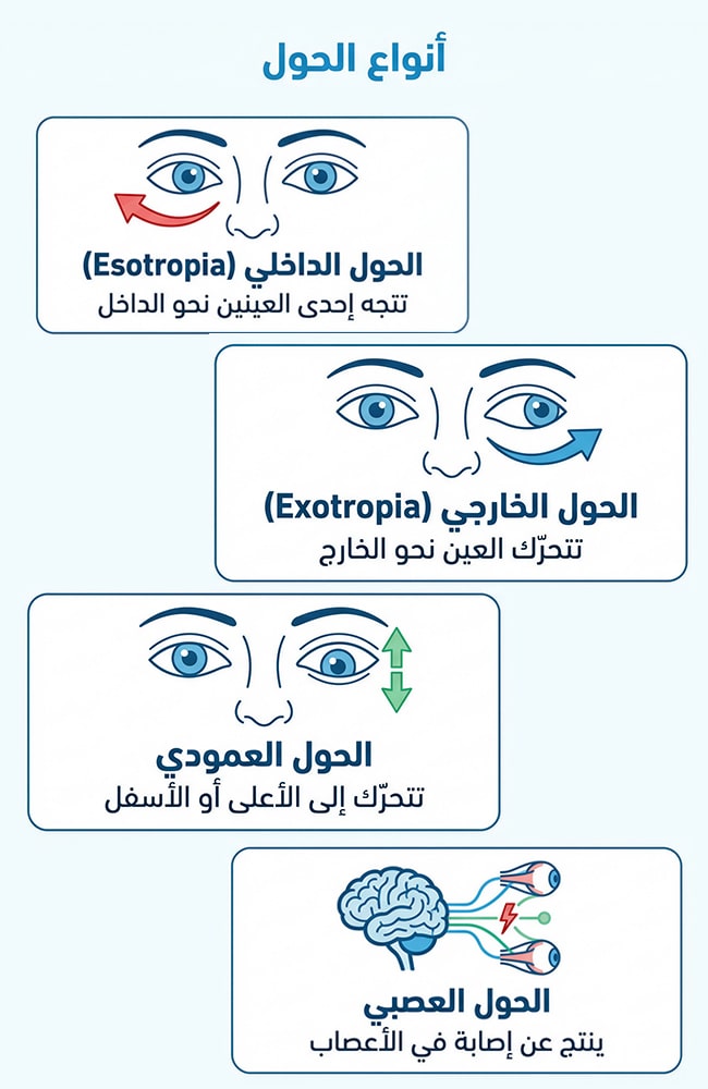 أنواع الحول.